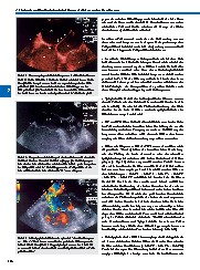 Thumbnail of page 2