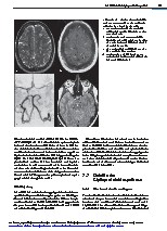 Thumbnail of page 1