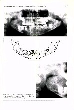 Thumbnail of page 3