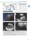 Thumbnail of page 3