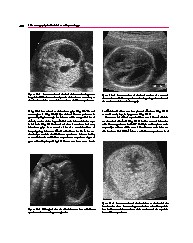 Thumbnail of page 2