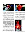 Thumbnail of page 2