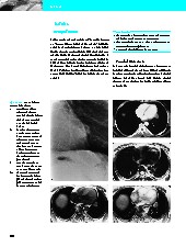 Thumbnail of page 2