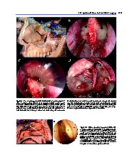 Thumbnail of page 3