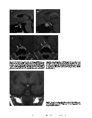 Thumbnail of page 3