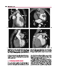 Thumbnail of page 1