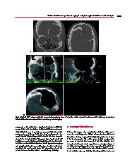 Thumbnail of page 2