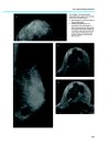 Thumbnail of page 2