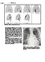 Thumbnail of page 2