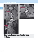 Thumbnail of page 3