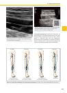 Thumbnail of page 3