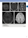 Thumbnail of page 2