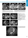 Thumbnail of page 2