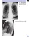 Thumbnail of page 2