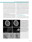 Thumbnail of page 2