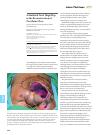 Article preview thumbnail